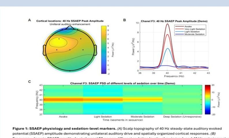 Three-panel scientific figure showing scalp topography of 40Hz SSAEP amplitude, frequency spectrum across sedation levels, and time-series PSD across awake, light, moderate, and deep sedation states