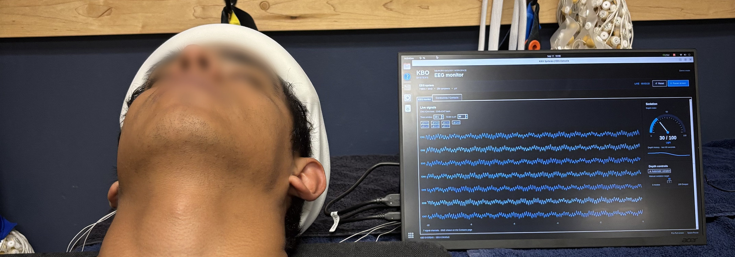 KBO prototype headband recording live EEG during testing